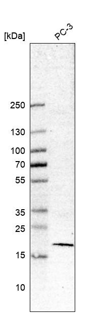 Western blot analysis in human cell line PC-3.
