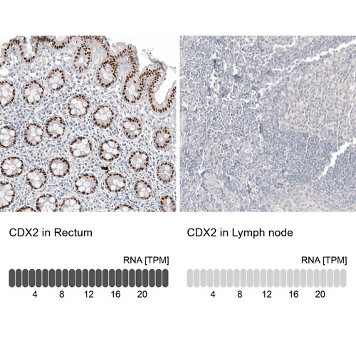 Immunohistochemistry analysis in human rectum and lymph node tissues using AMAb91828 antibody. Corresponding CDX2 RNA-seq data are presented for the same tissues.