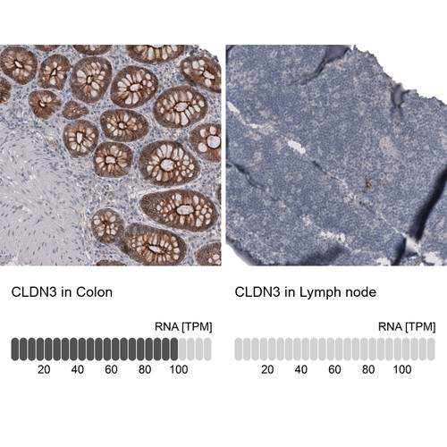 Immunohistochemistry analysis in human colon and lymph node tissues using AMAb91834 antibody. Corresponding CLDN3 RNA-seq data are presented for the same tissues.