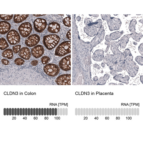 Immunohistochemistry analysis in human colon and placenta tissues using AMAb91835 antibody. Corresponding CLDN3 RNA-seq data are presented for the same tissues.