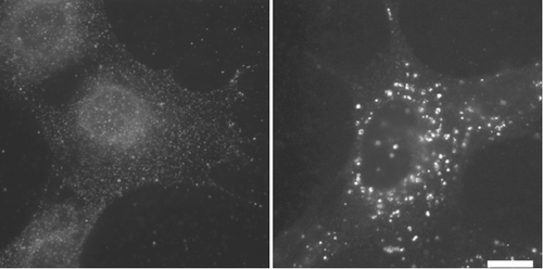 Figure 1. Immunofluorescence microscopy analysis of mouse embryonic fibroblasts (MEFs).
MEFs were cultured in DMEM supplemented with 10% FBS (left) or DMEM without amino acids (right) for 1 hr. After fixation with 4% paraformaldehyde for 10 min at room temperature, they were permeabilized with 50μg/ml digitonin for 5 min. Cells were then subjected to immunofluorescence microscopy using #1703 anti-LC3 antibody at 1:100 dilution. Scale bar, 20μm.