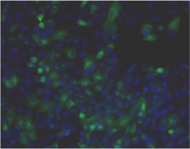 Figure 1. Immunohistochemistry.Hela cells ICAFectin441-transfected with a plasmid encoding human ITIH4 were fixed, permeabilized and stained with rat anti-human ITIH4 serum (diluted 1/50) and Alexa488 goat anti rat IgG secondary antibody. Nuclei were counterstained with DAPI.
