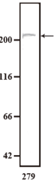 Figure 1. WB analysis.Whole cell lysate prepared from DJM-1 cells was immunoblotted with mAb 279 at 1:100 dilution. mAb 279 recognized BPAG1 (Bullous Pemphigoid antigen 1) as a band at approximately 230 kDa (arrow).