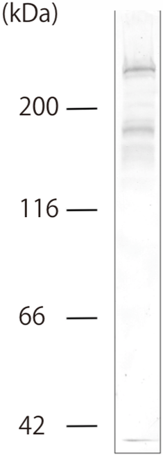 Figure 1. Western Blotting.Concentrated conditioned medium prepared from BMGE+H cells was immunoblotted with BML39 antibody (1:50 dilution). BML39 antibody detected type-7 collagen as a band at approximately 300 kDa (full-length) and degraded fragments around 170 kDa Conditioned medium was concentrated by ammonia sulfate precipitation as described previously (ref. 2). Polypeptides were separated by SDS-PAGE (7.5%).