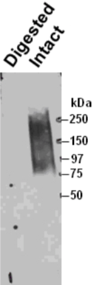 Figure 1. Immunoprecipitation of byglycan from human smooth muscle cells and Western blotting with a second anti-biglycan mAb on the intact (right) and chondroitinase ABC predigested (left) precipitate resolved by SDS-PAGE on gradient 4-18% gels.