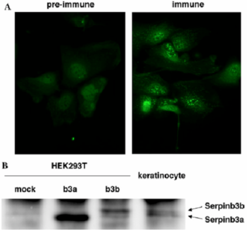 Anti Squamous Cell Carcinoma Antigen 2 (SERPINB3A/SQN-5) pAb (Rabbit, Antiserum)