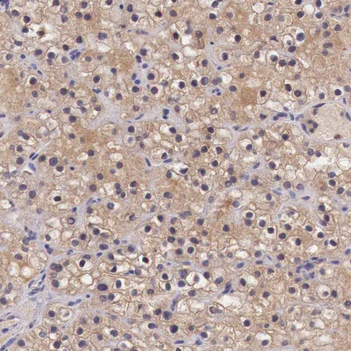 Immunohistochemical staining of human parathyroid gland shows cytoplasmic positivity in glandular cells.
