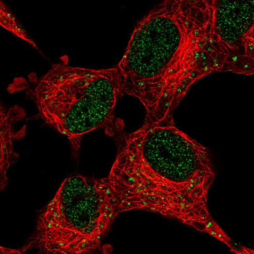 Immunofluorescent staining of human cell line SH-SY5Y shows localization to nucleoplasm & vesicles.