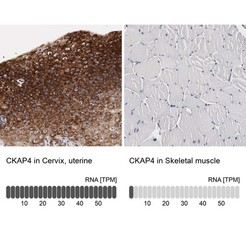 Immunohistochemistry analysis in human cervix, uterine and skeletal muscle tissues using Anti-CKAP4 antibody. Corresponding CKAP4 RNA-seq data are presented for the same tissues.
