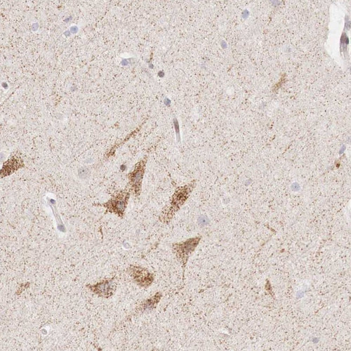 Immunohistochemical staining of human cerebral cortex shows moderate granular positivity in neuronal cells.