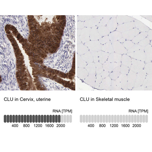 Immunohistochemistry analysis in human cervix, uterine and skeletal muscle tissues using HPA000572 antibody. Corresponding CLU RNA-seq data are presented for the same tissues.