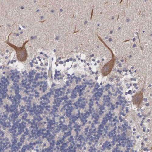 Immunohistochemical staining of human cerebellum shows moderate cytoplasmic positivity in purkinje cells.