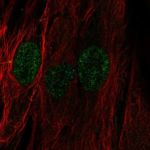 Immunofluorescent staining of human cell line BJ shows localization to nucleus.