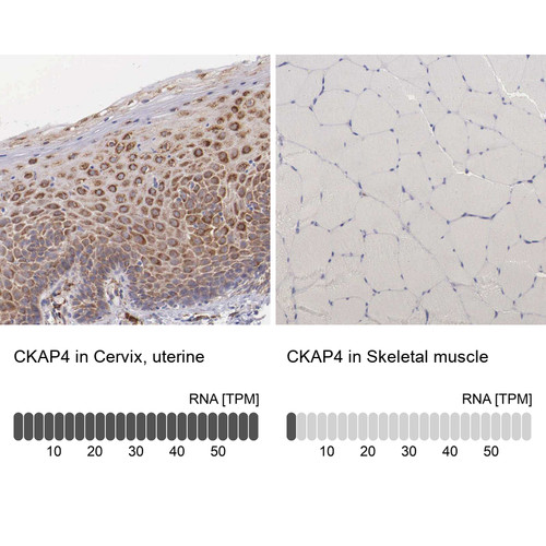Immunohistochemistry analysis in human cervix, uterine and skeletal muscle tissues using Anti-CKAP4 antibody. Corresponding CKAP4 RNA-seq data are presented for the same tissues.