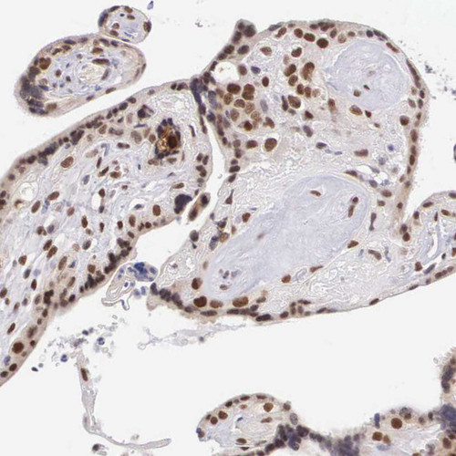 Immunohistochemical staining of human placenta shows strong nuclear positivity in trophoblastic cells.