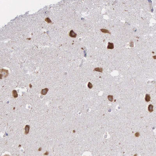 Immunohistochemical staining of human hippocampus shows strong cytoplasmic positivity in neuronal cells.