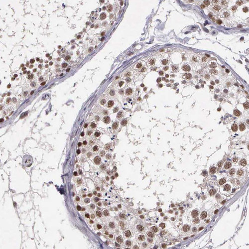 Immunohistochemical staining of human testis shows distinct nuclear positivity in cells in seminiferus ducts.