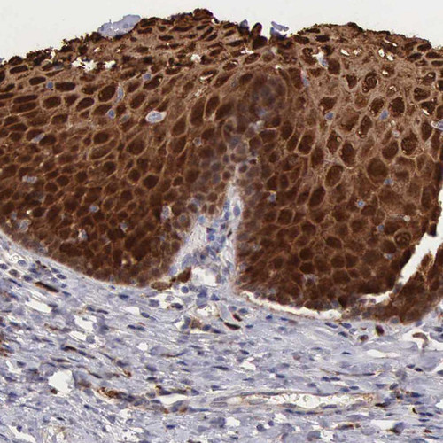 Immunohistochemical staining of human esophagus shows strong cytoplasmic and membranous positivity in squamous epithelial cells.