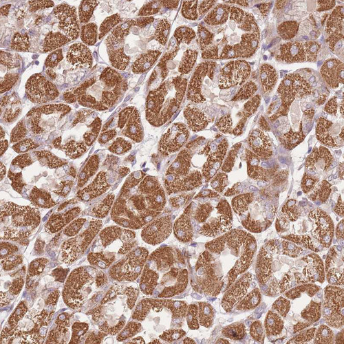Immunohistochemical staining of human stomach shows moderate to strong cytoplasmic positivity in glandular cells.