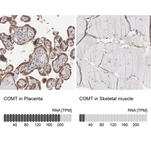 Immunohistochemistry analysis in human placenta and pancreas tissues using Anti-COMT antibody. Corresponding COMT RNA-seq data are presented for the same tissues.