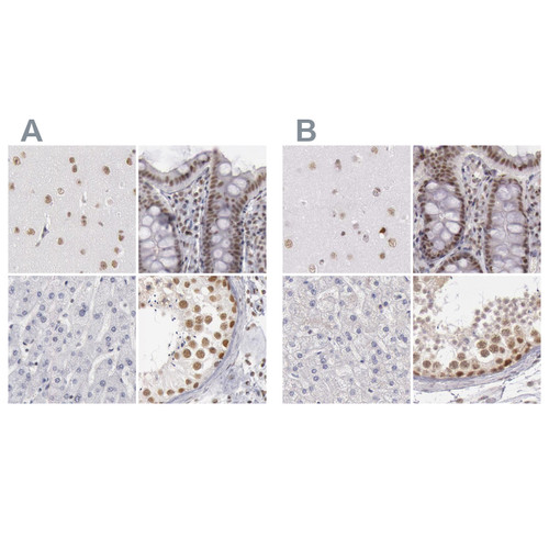 Immunohistochemical staining of human cerebral cortex, colon, liver and testis using Anti-DGCR14 antibody HPA001221 (A) shows similar protein distribution across tissues to independent antibody HPA001222 (B).