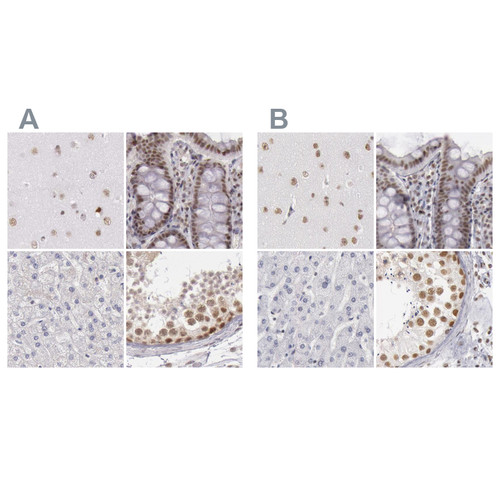Immunohistochemical staining of human cerebral cortex, colon, liver and testis using Anti-DGCR14 antibody HPA001222 (A) shows similar protein distribution across tissues to independent antibody HPA001221 (B).