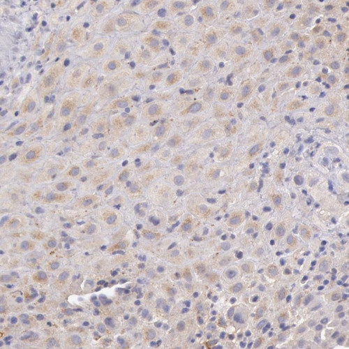 Immunohistochemical staining of human placenta shows weak cytoplasmic positivity in decidual cells.