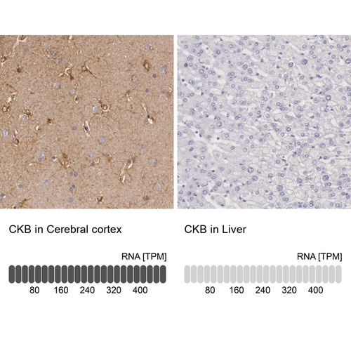 Immunohistochemistry analysis in human cerebral cortex and liver tissues using HPA001254 antibody. Corresponding CKB RNA-seq data are presented for the same tissues.