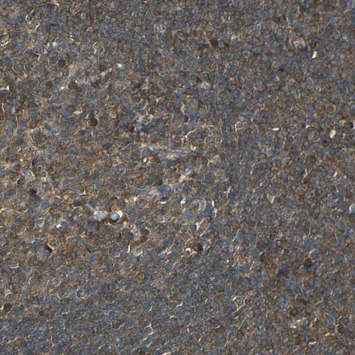 Immunohistochemical staining of human tonsil shows moderate cytoplasmic positivity in germinal center and non-germinal center cells.
