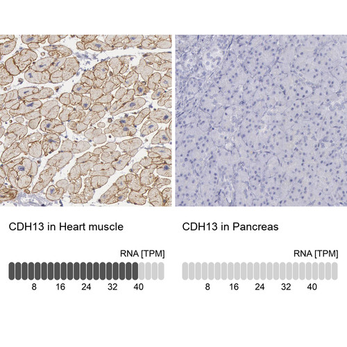 Immunohistochemistry analysis in human heart muscle and pancreas tissues using HPA001380 antibody. Corresponding CDH13 RNA-seq data are presented for the same tissues.