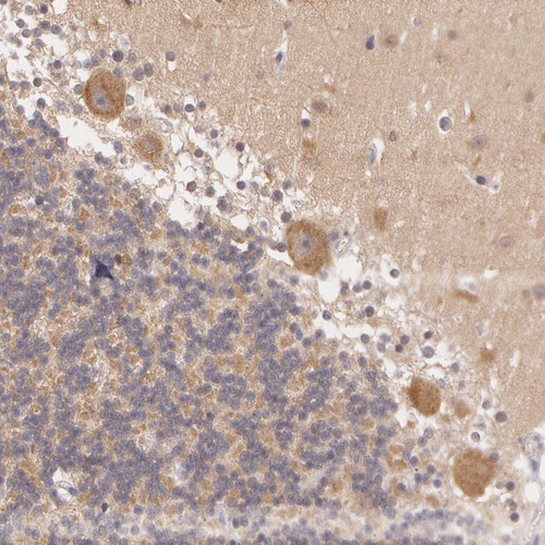 Immunohistochemical staining of human Cerebellum shows moderate cytoplasmic positivity in Purkinje cells.