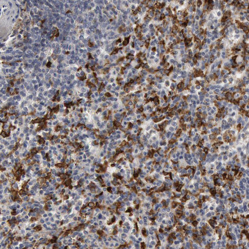 Immunohistochemical staining of human spleen shows strong cytoplasmic positivity in cells in red pulp.