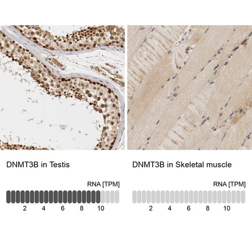Immunohistochemistry analysis in human testis and skeletal muscle tissues using Anti-DNMT3B antibody. Corresponding DNMT3B RNA-seq data are presented for the same tissues.