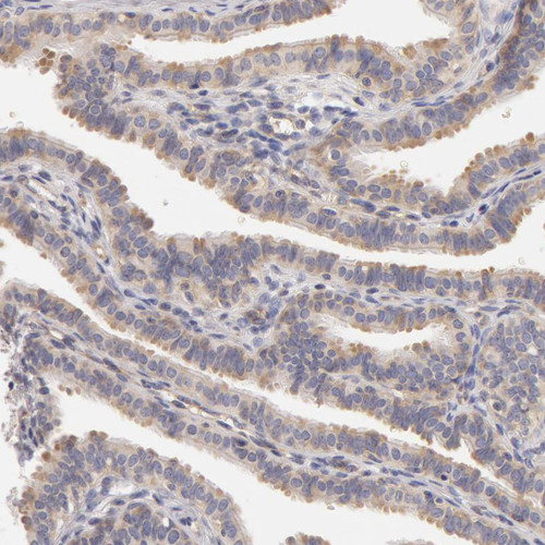 Immunohistochemical staining of human Fallopian tube shows weak cytoplasmic positivity in glandular cells.