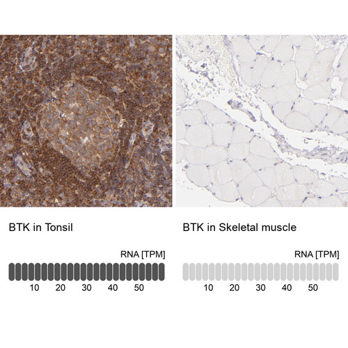Immunohistochemistry analysis in human tonsil and skeletal muscle tissues using HPA002028 antibody. Corresponding BTK RNA-seq data are presented for the same tissues.