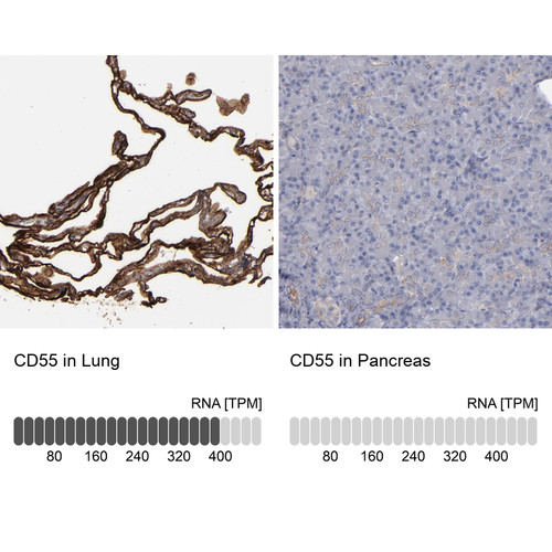Immunohistochemistry analysis in human lung and pancreas tissues using HPA002190 antibody. Corresponding CD55 RNA-seq data are presented for the same tissues.