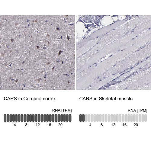 Immunohistochemistry analysis in human cerebral cortex and skeletal muscle tissues using Anti-CARS antibody. Corresponding CARS RNA-seq data are presented for the same tissues.