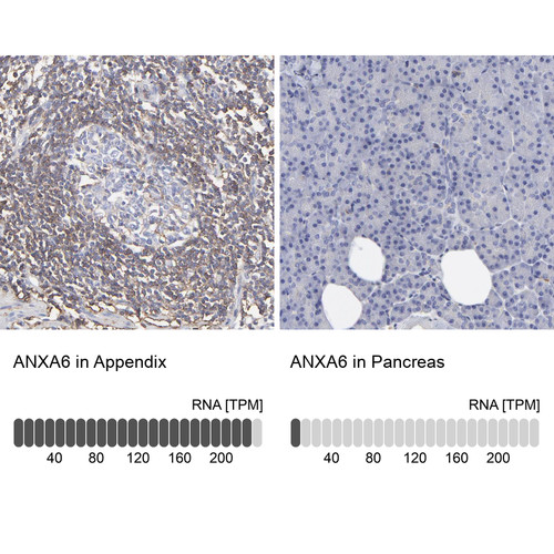 Immunohistochemistry analysis in human appendix and pancreas tissues using Anti-ANXA6 antibody. Corresponding ANXA6 RNA-seq data are presented for the same tissues.