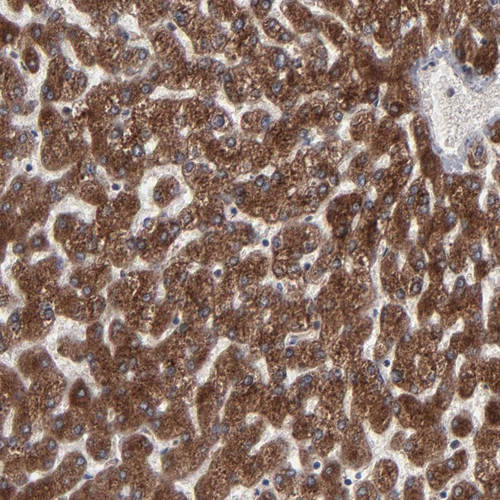 Immunohistochemical staining of human liver shows strong cytoplasmic positivity in hepatocytes.