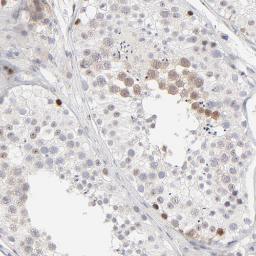 Immunohistochemical staining of human testis shows moderate cytoplasmic positivity in a subset of cells in seminiferous ducts.