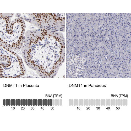 Immunohistochemistry analysis in human placenta and pancreas tissues using Anti-DNMT1 antibody. Corresponding DNMT1 RNA-seq data are presented for the same tissues.