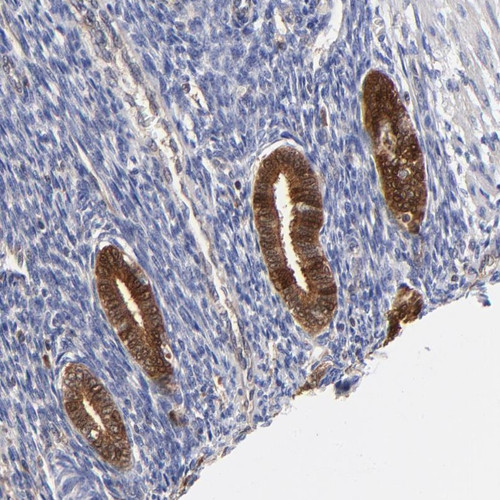 Immunohistochemical staining of human corpus, uterine shows strong cytoplasmic and nuclear positivity in glandular cells.