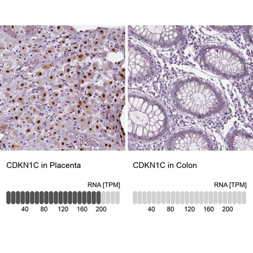 Immunohistochemistry analysis in human placenta and colon tissues using Anti-CDKN1C antibody. Corresponding CDKN1C RNA-seq data are presented for the same tissues.