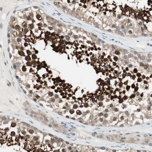 Immunohistochemical staining of human testis shows strong nuclear and cytoplasmic positivity in cells in seminiferous ducts.