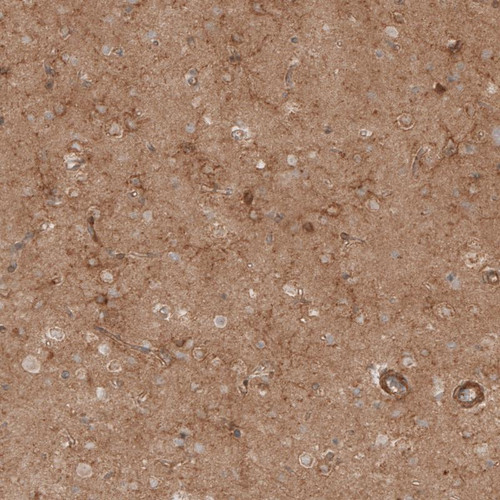Immunohistochemical staining of human cerebral cortex shows moderate positivity in neuropil.