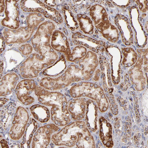 Immunohistochemical staining of human liver shows strong cytoplasmic positivity in hepatocytes.