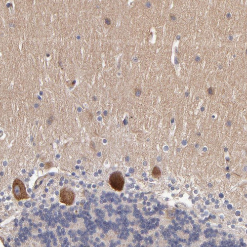 Immunohistochemical staining of human cerebellum shows strong cytoplasmic positivity in Purkinje cells.