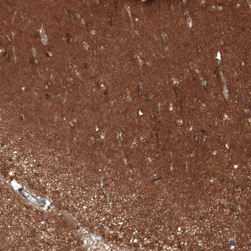 Immunohistochemical staining of human cerebral cortex shows moderate cytoplasmic/ membranous positivity in neurons and moderately stained neuropil.