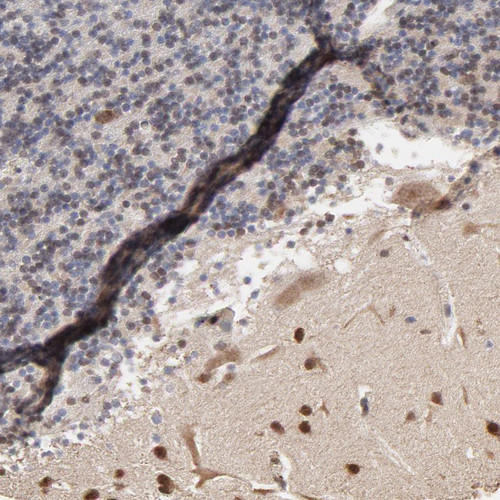 Immunohistochemical staining of human cerebellum shows strong positivity in cells in molecular layer.