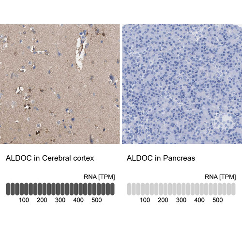 Immunohistochemistry analysis in human cerebral cortex and pancreas tissues using HPA003282 antibody. Corresponding ALDOC RNA-seq data are presented for the same tissues.